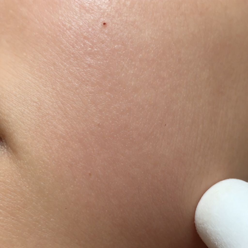 The image displays a highly magnified view of light-toned human skin, revealing numerous small, dark pore blockages scattered across the surface. Several lighter, raised bumps are also visible among the fine skin texture. A white, soft-looking implement is partially seen in the lower right corner, suggesting a close examination or procedure.