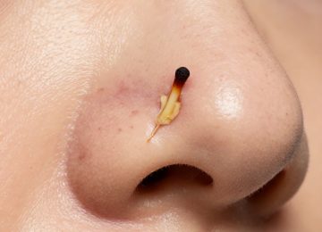 8 DIY Remedies to Remove Blackheads at Home Naturally