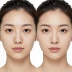 Achieving Smoother, Even-Toned Skin: Real Transformation and Cosmetic Improvement