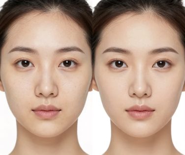 Achieving Smoother, Even-Toned Skin: Real Transformation and Cosmetic Improvement