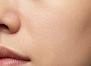 Blackhead Removal and Pore Minimizing Treatment: Realistic Results Explained