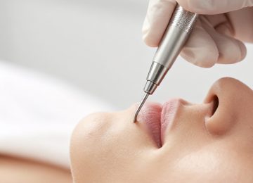 Clinical Mechanics of Professional Facial Blackhead Removal and Comedone Extraction