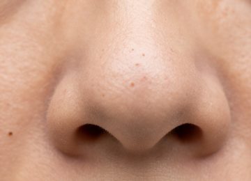 Close-Up Human Skin Texture: Understanding Visible Pores and Blackheads