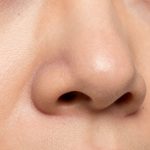 Close-up View of Human Skin Reveals Blackheads and Pores