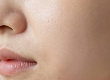 Effective Home Remedies for Removing Facial Blackheads and Minimizing Pores