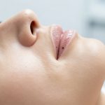 Effective Methods for Managing and Removing Stubborn Blackheads from Pores