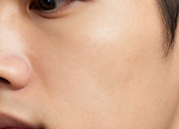 Embracing Natural Skin Texture and Hyperpigmentation for Better Dermal Health