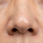 Extreme Close-Up of Enlarged Pores and Blackheads on Human Skin Texture