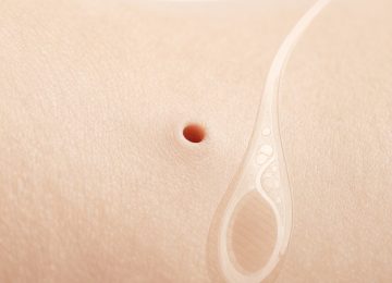 How to Safely Remove Blackheads and Prevent Clogged Skin Pores