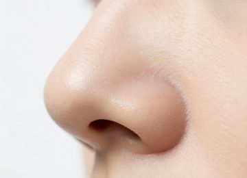 How to Safely Remove a Small Blemish From Your Nostril Rim