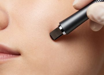 Practical Guide to Blackhead Extraction: Removing Clogged Pores Safely