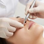 Professional Dermatological Pore Extraction: Procedure and Skin Care Benefits