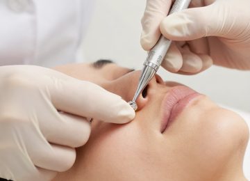Professional Dermatological Pore Extraction: Procedure and Skin Care Benefits