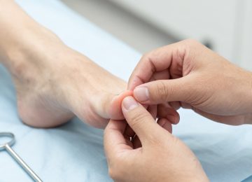 Professional Ingrown Toenail Treatment and Clinical Medical Procedure Guide