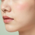 Science-Backed Strategies for Achieving Long-Term Acne Treatment Results