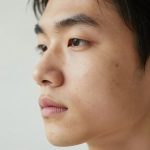 Simple Skincare Routine for Teen Acne and Clearer Skin