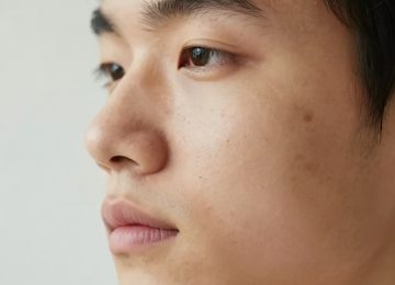 Simple Skincare Routine for Teen Acne and Clearer Skin