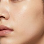 Skincare Routine for Glass Skin with Acne Breakouts and Scars