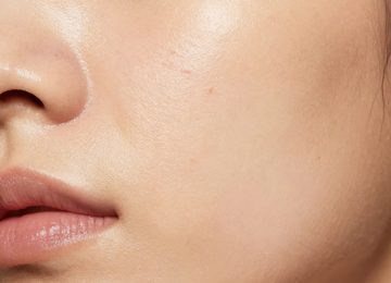 Skincare Routine for Glass Skin with Acne Breakouts and Scars
