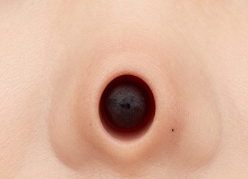 Topical Skincare Treatments for Blackhead Removal and Prevention