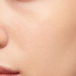Understanding Dark Pores on Light, Peachy Skin: Causes and Appearance