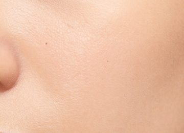 Understanding Dark Pores on Light, Peachy Skin: Causes and Appearance