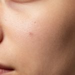 Understanding Facial Skin Texture and Pore Visibility in Macro Photography