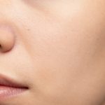 Understanding Normal Facial Skin Texture, Pores, and Dark Spots