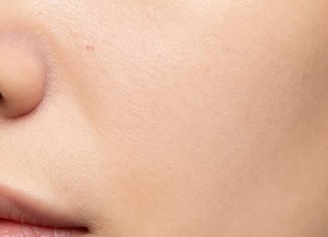 Understanding Normal Facial Skin Texture, Pores, and Dark Spots