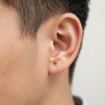 Understanding Sebaceous Cysts Located Behind the Ear: Causes and Characteristics