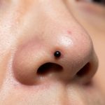 Understanding the Blackhead: A Closer Look at That Dark Pore