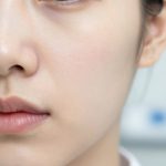 Understanding the Long-Term Results of Professional Clinical Acne Treatments